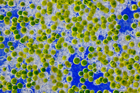 Microscopic view of a Horsetail (Equisetum arvense) spores with elaters. Rheinberg illumination.