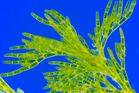 Microscopic view of green algae (Cladophora). Rheinberg illumination.の写真素材