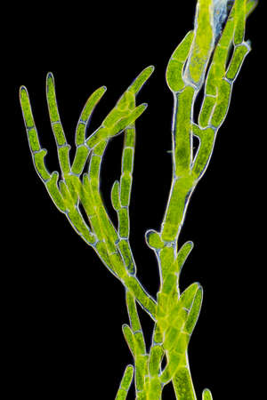 Microscopic view of green algae (Cladophora) branch. Darkfield illumination.
