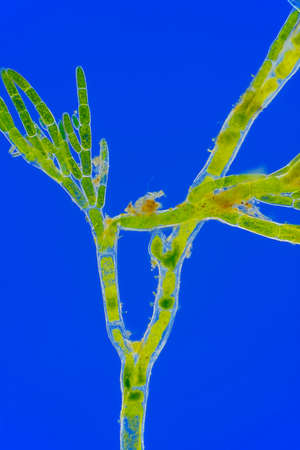 Microscopic view of green algae (Cladophora) branch. Rheinberg illumination.の写真素材