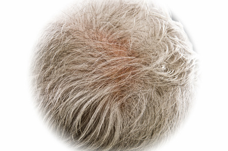 Gray hair thinning on senior man scalpの写真素材