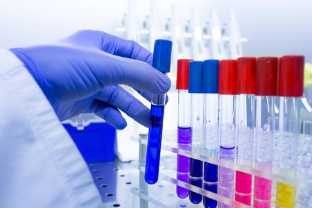 Close up of biologist's hand in protective gloves holding test tube with chemicals in laboratory