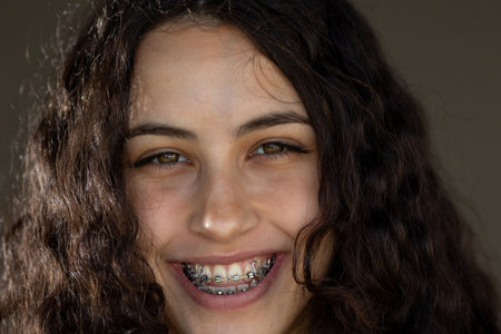 Portrait of pretty girl with curly hair smiling and showing metal braces on teethの写真素材