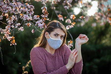 Pretty young woman scratching arm beside blooming tree in park in spring. Redness and itchy skin as allergic reactionの写真素材