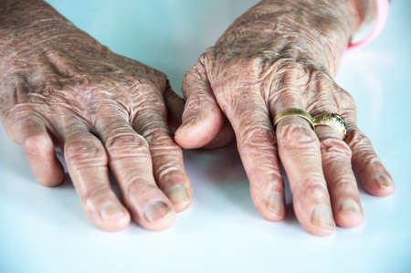old woman hand with wedding ring