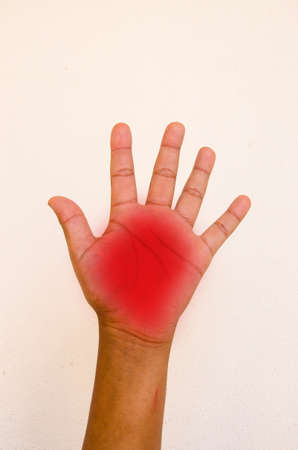 children hand injury on white backgroundの写真素材