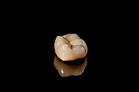 Dental implant. Restoration of teeth. Dental surgeon. Dental laboratory. Dental clinic. Implants of...
