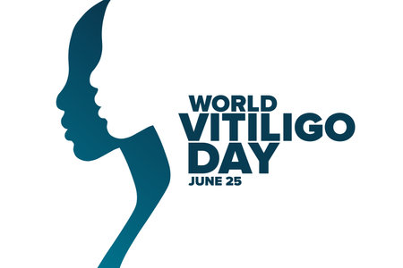 World Vitiligo Day. June 25. Holiday concept. Template for background, banner, card, poster with text inscription. Vector illustration.のイラスト素材