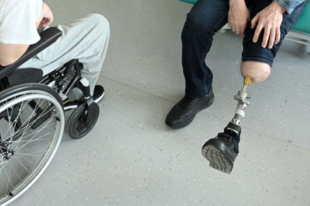 a man with bone-implanted leg prostheses. osteointegrationの写真素材