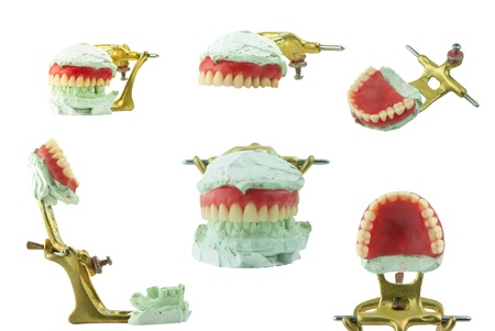 upper denture wax model setの写真素材