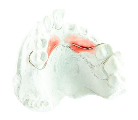 Plaster denture model with wire for make denture on white background