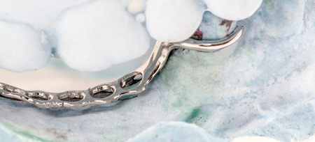 partial denture on a plaster moldの写真素材