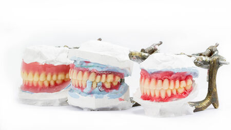 Wax denture,dental models showing different types on white background