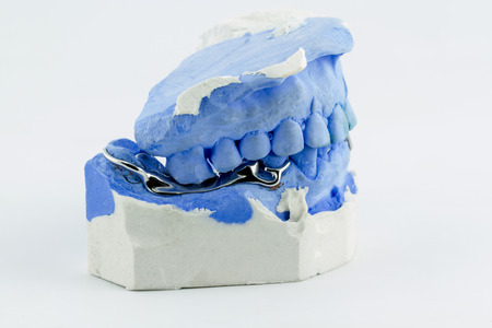 a partial denture on white backgroundの写真素材