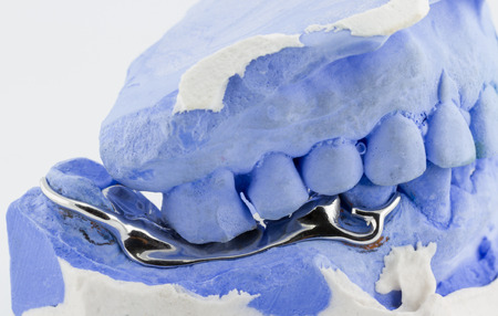 a partial denture on white background