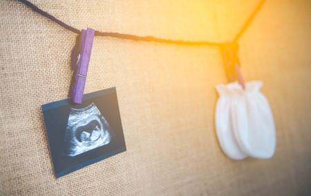 Medical images collage of ultrasound during woman pregnancy showing fetus in third month and...