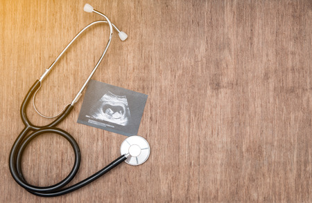 baby ultrasound picture and stetoscope on wooden background