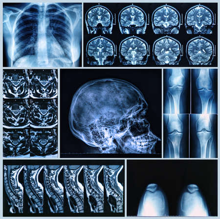 Radiography of Human Bones: x-ray and MRI scansの写真素材