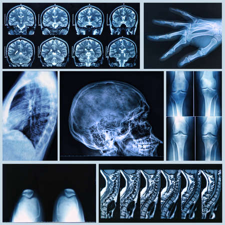 Radiography of Human Bones  x-ray and MRI scansの写真素材
