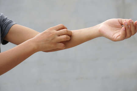 Woman scratching arm from itching on light gray background. Cause of itchy skin include insect...