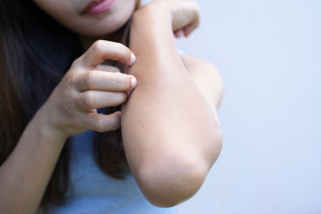 Asian woman has itching on her  arms.