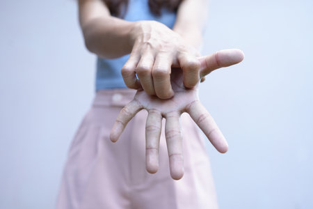 Asian woman has itching on her handの写真素材