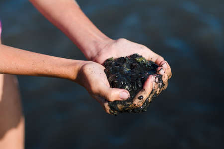 An alternative treatment for psoriasis and other skin diseases with therapeutic mud from a salt...