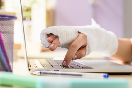 Close-up of a teenager's hand with a broken arm uses a laptop. Selective plan on the finger.の写真素材