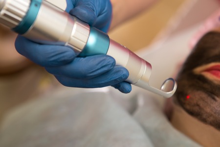 Laser removal of skin discoloration.Cosmetic clinic, woman during laser facial surgery.の写真素材