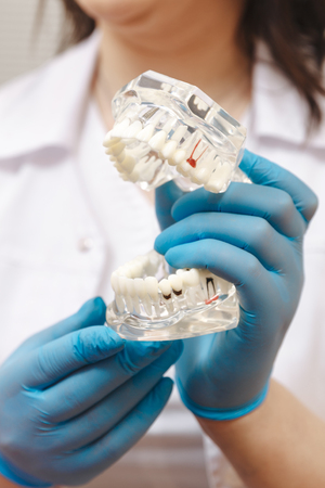 Closeup view of jaw model in dentist's handsの写真素材