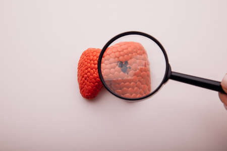 Search for disease or pathology of the thyroid glandの写真素材