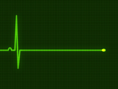 Abstract heart beats cardiogram for you designの写真素材