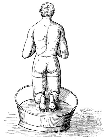Hydrotherapy of the back of the body. Illustration of the 19th century. Germany. White background.の写真素材