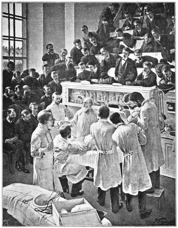 The German surgeon Theodor Billroth operating in the auditorium of Vienna General Hospital (Allgemeine Krankenhaus). Illustration of the 19th century. Germany. White background.のeditorial素材
