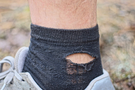 one leg of a man in a sneaker and a black sock with a torn hole on a summer streetの写真素材
