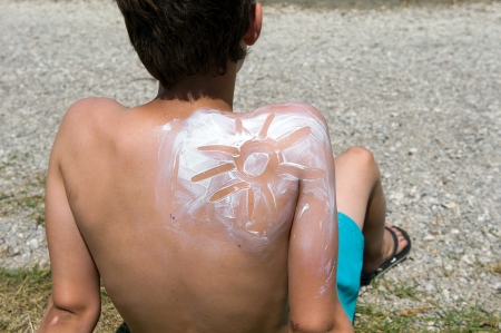 A boy with suntan on his back in the shape of the sunの写真素材