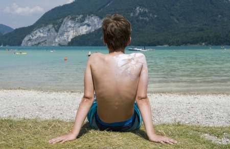 A boy with suntan on his back in the shape of the sunの写真素材