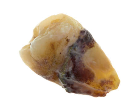 Top view of a single highly decayed wisdom tooth isolated on a white background.