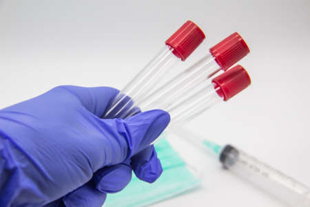 Coronavirus blood test 2019.Coronavirus came  Doctor hand in medical glove holding empty tubes for test Coronavirus in laboratory. Concept can be used in the designの写真素材