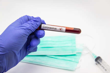 Coronavirus blood test 2019.Coronavirus came Doctor hand in medical glove holding test tube with Coronavirus positive blood in laboratory. Concept can be used in the designの写真素材