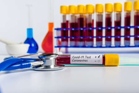 Covid-19 - test tube with blood of a patient with virus with positive result. Quarantine Novel Coronavirus pneumoniaの写真素材