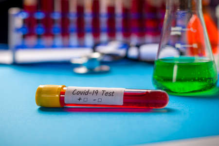 Covid-19 - diagnostic laboratory and test tube with blood of a patient with virus. Novel Coronavirus pneumoniaの写真素材