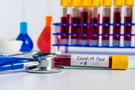 Covid-19 - diagnostic laboratory and test tube with blood of a patient with virus. Novel Coronavirus pneumoniaの写真素材