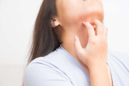 Women scratch the itch with hand ,neck, itching, Concept with Healthcare And Medicine.