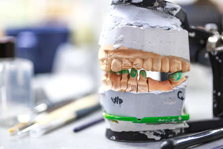 Dental articulator in dental labの写真素材