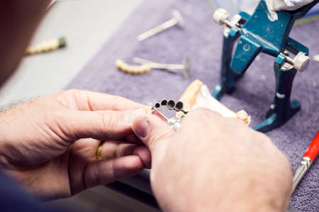 Dental technician working on a metallic prosthesisの写真素材