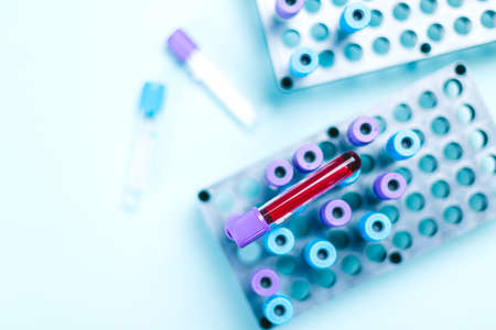 Tube sample with blood sample over a rake with medical samples in the medical analysis lab. Blood...