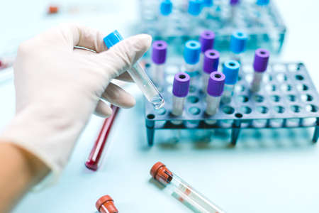 Doctor with medical glove handling a vial with medical samples in the analysis laboratoryの写真素材