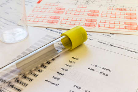 Test tube for urine examinationの写真素材