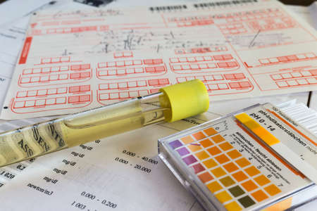 Test tube for urine examinationの写真素材